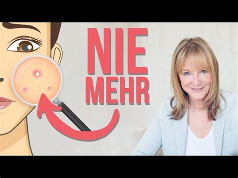 Doch um diese pickelmale zu entfernen oder zumindest aufzuhellen kannst du ein paar dinge tun. Honig gegen aknenarben - check nu onze hoogstaande ...