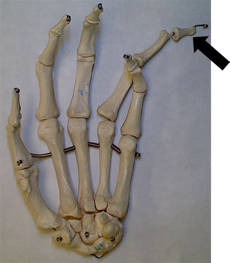 Unit 6 - Appendicular Skeleton - Stagg High School Anatomy & Physiology