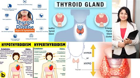 Thyroid Nutritionist Counseling In Mumbai Thyroid Diet Diet For