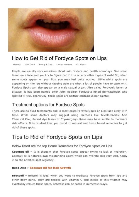 How To Get Rid Of Fordyce Spots On Lips Yabibo