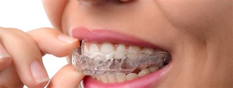 Things You Need To Know About Invisalign Shinagawa Dental Blog