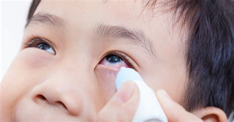 Causes Of White Eye Discharge Livestrongcom