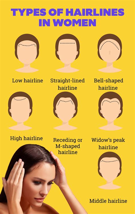 Different Types Of Hairline In Women And How To Care For Them Portal