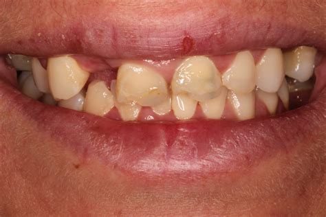 NHS & Private Dentist in Stoke-on-Trent | Pall Mall Dental