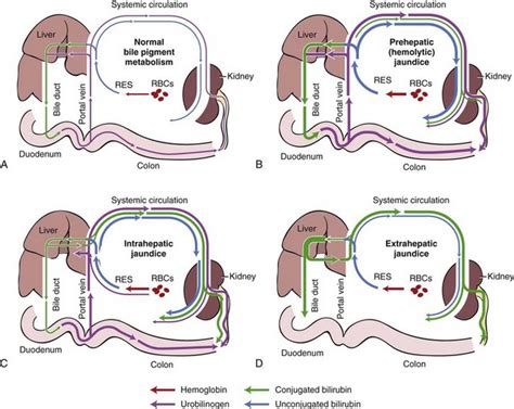 However, enhancement of bilirubin excretion in vivo was observed only in heterozygous gunn rats. Icterus | Veterian Key