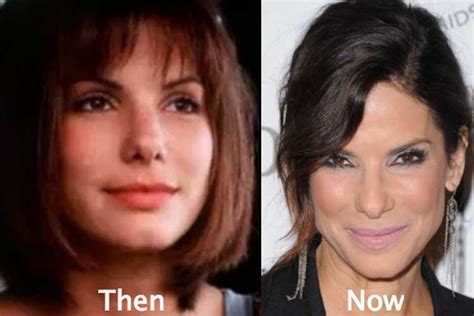 Sandra Bullock Plastic Surgery Nose Job Facelift Botox