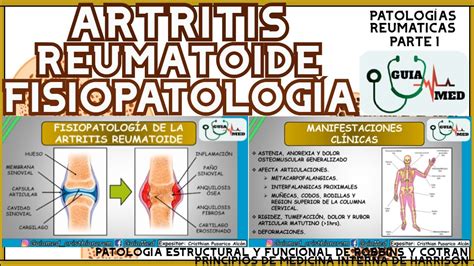 ARTRITIS REUMATOIDE FISIOPATOLOGÍA GuiaMed YouTube