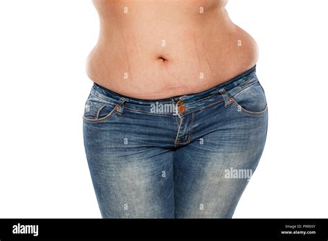 Fat Woman Hi Res Stock Photography And Images Alamy