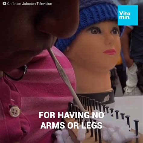 growing up without arms or legs “they all believe i cannot do anything because i have no arms