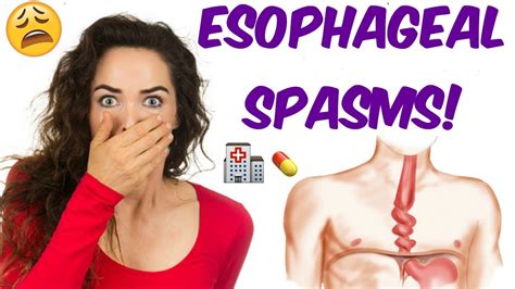Spasms And Nutcracker Esophagus IS YOUR ESOPHAGUS GOING NUTS YouTube