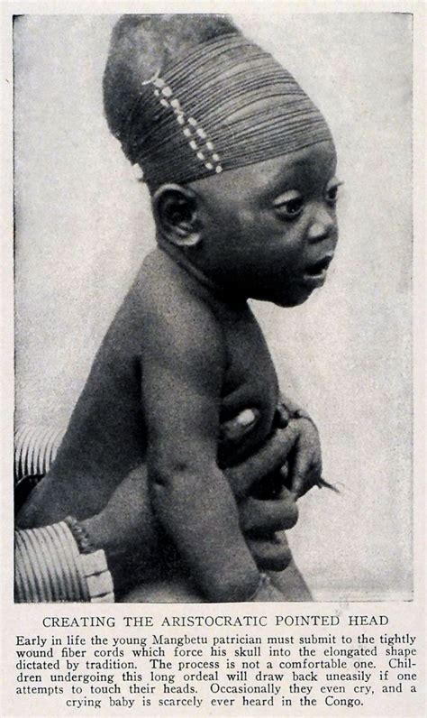 Africa Creating The Aristocratic Pointed Head Baby Mangbetu Skull