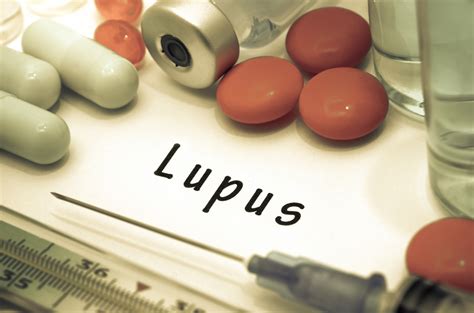 Lupus And Hair Loss Causes Symptoms Diagnosis And Treatment