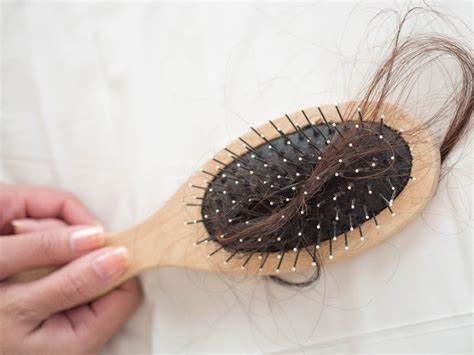 23 Fibromyalgia Hair Loss Ingridekanshi