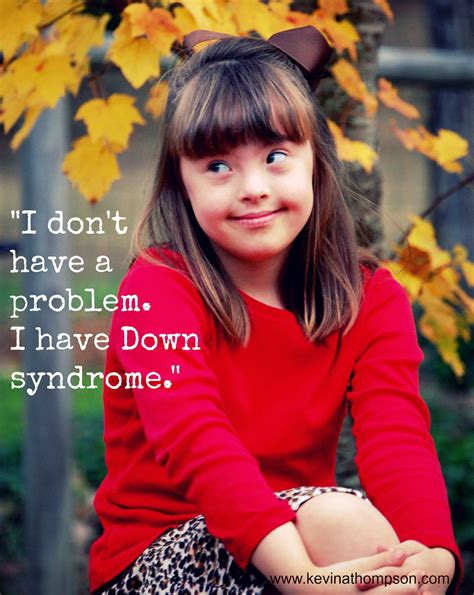 Common down syndrome effects can include thyroid problems, hearing problems, congenital heart disease, eye problems, and joint and muscle problems. Down Syndrome Is Not My Problem - Kevin A. Thompson