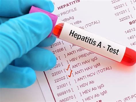 Anti-hcv Para Que Serve