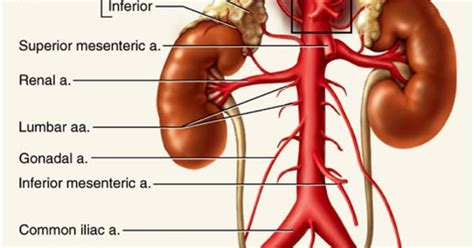 What do you prefer to learn with? abdominal arteries diagram | gastro | Pinterest