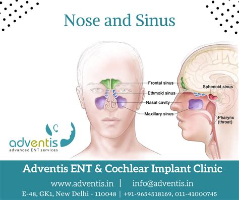 Medication or surgery can help. Book appointment with best nose, sinus Rhinology surgery ...
