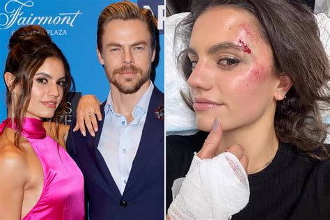 derek hough and hayley erbert say they are both okay after scary car accident
