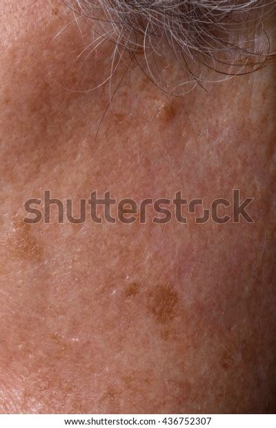 Spots On Face Senior Woman Stock Photo 436752307 Shutterstock