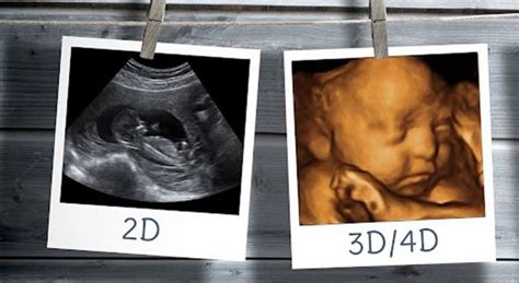 ¿cuándo Se Hace La Ecografía 4d Descubriendo A Laura