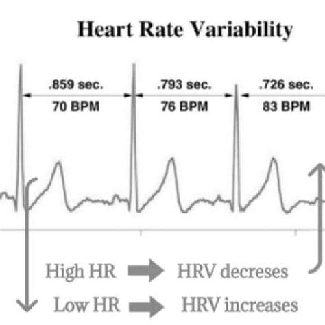 Heart Rate Variability Interpretation Abbreviations Bpm Beats Per