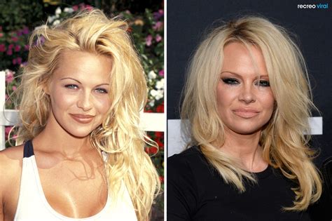 She transitioned at a young age. 10 Famosos que recurrieron al bisturí y se echaron a perder