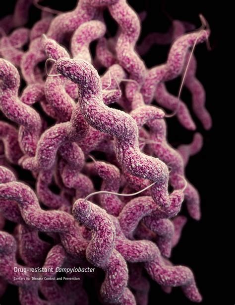 Ucla Hospital Cites Scopes As Behind Superbug Outbreak Cnn