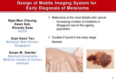 Design Of Mobile Imaging System For Early Diagnosis Of Melanoma
