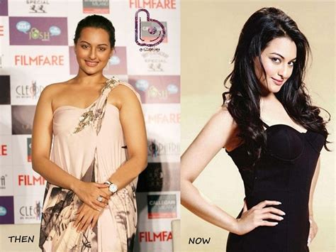 Sonakshi Sinha Before And After