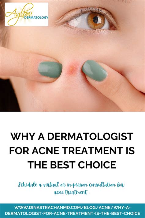 Why a dermatologist for acne treatment is the best choice – Artofit
