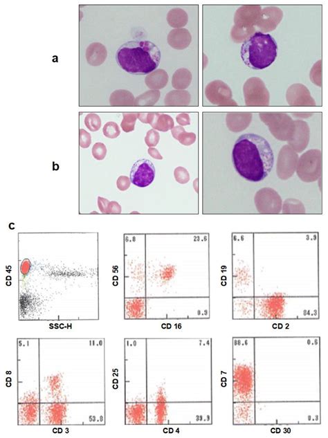 Reports Free Full Text Emergence Of Natural Killer Cell Large
