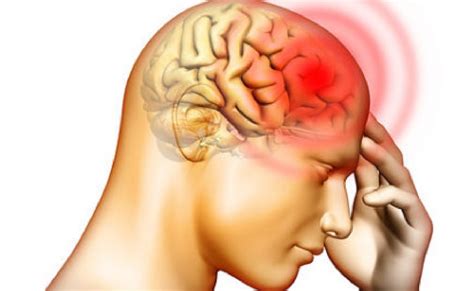 Heres How To Get Rid Of A Headache In Five Minutes Without Using Pills