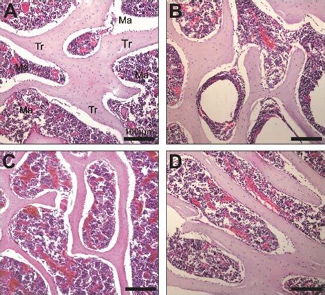 Bone Histology Of Artibeus Lituratus Females Representive Areas Of