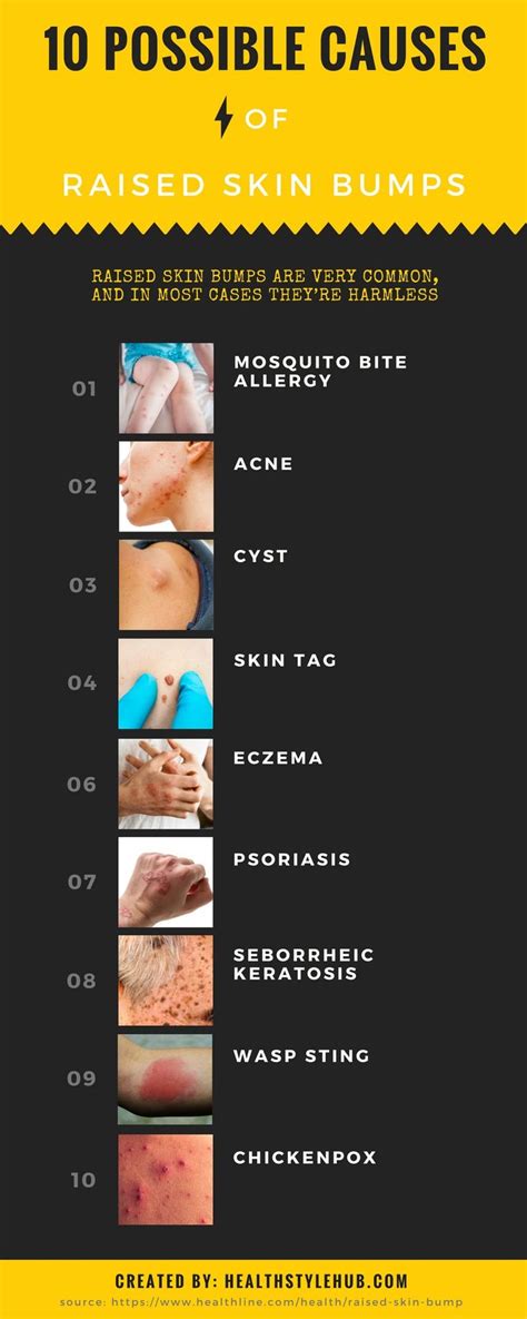 10 Possible Causes Of Raised Skin Bumps Skin Bumps Seborrheic