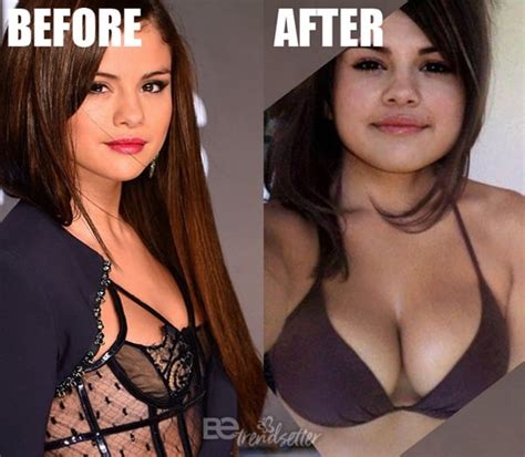 selena gomez plastic surgery revealed before and after 2019