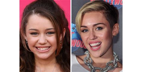 32 Celebs Who Owe Their Smiles To Cosmetic Dentistry Celebrity Teeth