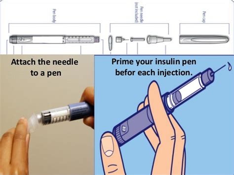 Ueda2016 Wark Shop Insulin Pens Precise Injection Technique K