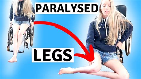 ♿️my Paralysed Legs Limbdifferenceawarenessmonth Youtube