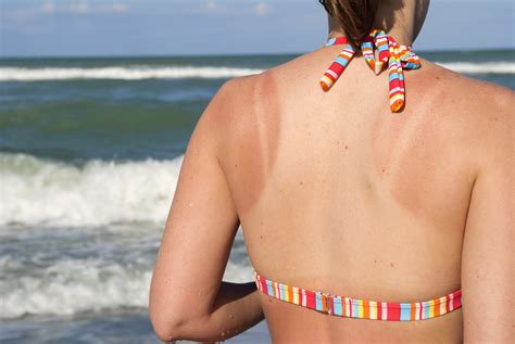 Local Researchers May Have Found The Secret To Safe Tanning Boston