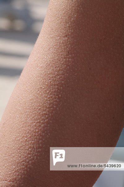 Goosebumps Skin Why Do We See Goosebumps On Our Skin Nicholas Willocip