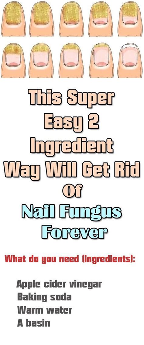 This Super Easy 2 Ingredient Way Will Get Rid Of Nail Fungus Forever