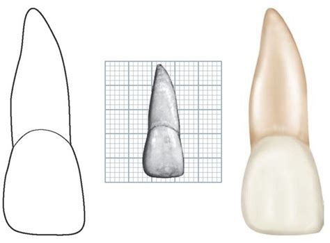 The Permanent Maxillary Incisors Dental Anatomy Physiology And