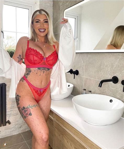 Love Island S Olivia Bowen Praised By Fans For Showing Her Psoriasis In