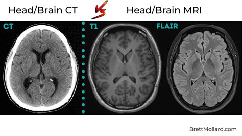 Ct Scan Vs Mri Whats The Difference