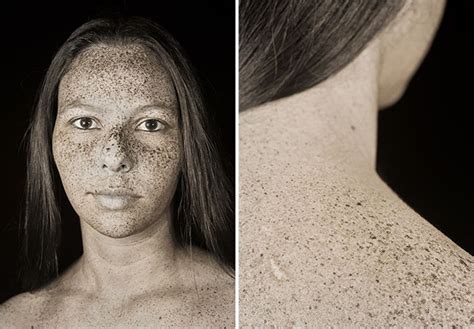 Uv Portraits Showed How Sunlight Damages The Skin Earth Chronicles News