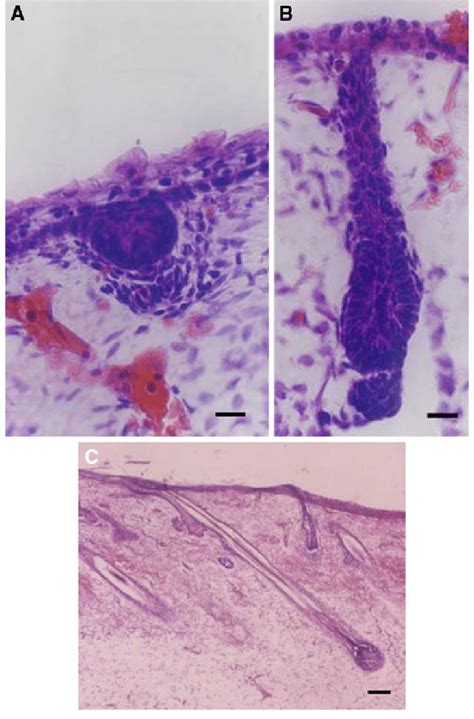 Histology of human hair follicle morphogenesis. Sections ...
