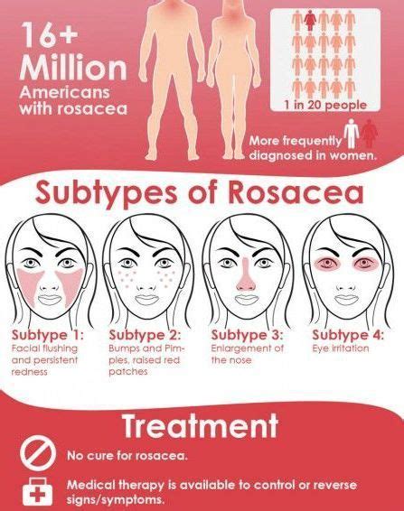 Rosacea Is A Relatively Common Chronic Skin Disorder With Symptoms