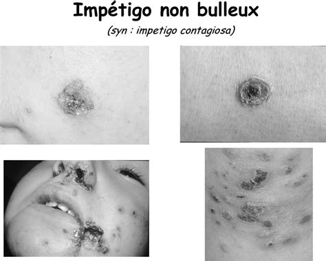 Dermatologie Et Sport Pdf Téléchargement Gratuit