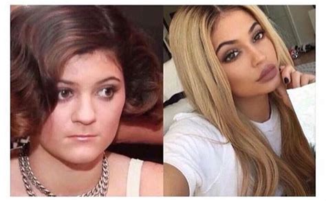 May be, may be not! Kylie Jenner before and after | Gesichtsbehandlung ...
