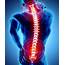 What Is A Spinal Laminectomy And How Does It Work